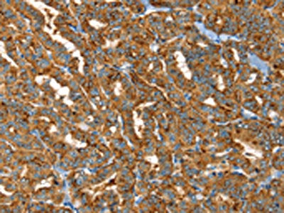 PTPN3 Antibody