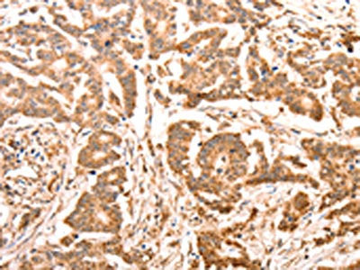 ACO2 Antibody