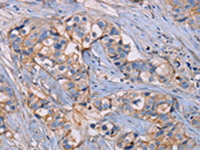 GHITM Antibody