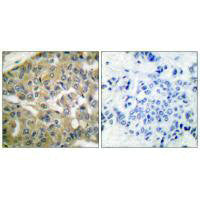 FHIT Antibody