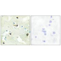 EPHB1/EPHB2/EPHB3 Antibody