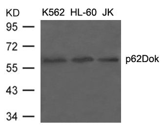 DOK1 (Ab-398) Antibody