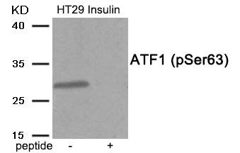 Phospho-ATF1 (Ser63) Antibody
