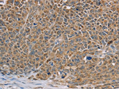 NDUFS7 Antibody