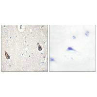 ADCY6/ADCY5 Antibody