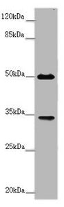 FCGR2B Antibody