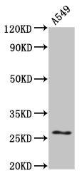 HSPB1 Antibody