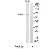 MEN1 Antibody