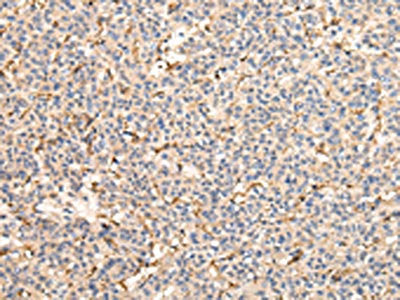 VPS41 Antibody