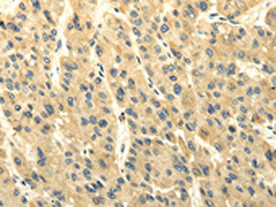 ABCB7 Antibody