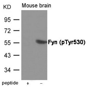 Phospho-FYN (Tyr530) Antibody