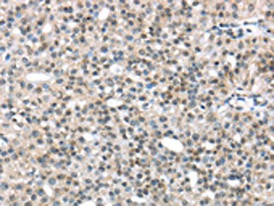 TRIP6 Antibody