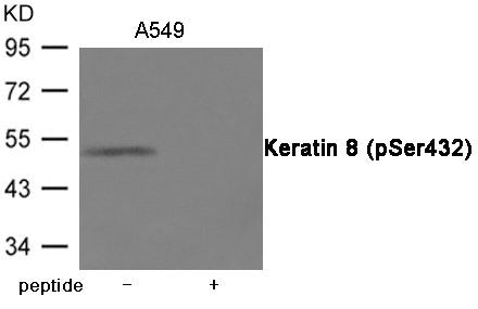 Phospho-KRT8 (Ser432) Antibody