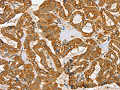 PDP1 Antibody