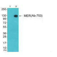 MERTK/TYRO3 (Ab-753) Antibody