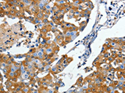 DPYSL5 Antibody