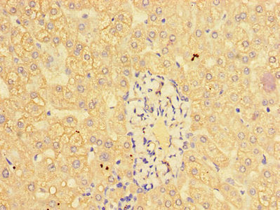 CTSL Antibody