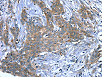 SCPEP1 Antibody