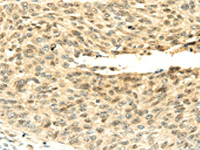 SHPRH Antibody