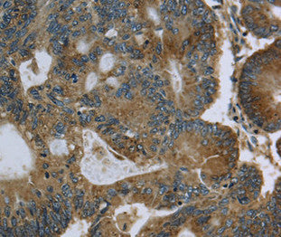 GK Antibody