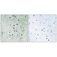 REXO1 Antibody