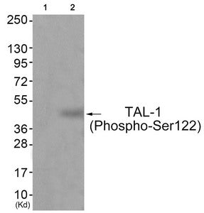 Phospho-TAL1 (Ser122) Antibody