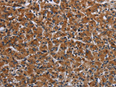 IRGM Antibody