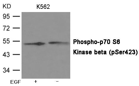 Phospho-RPS6KB2 (Ser423) Antibody