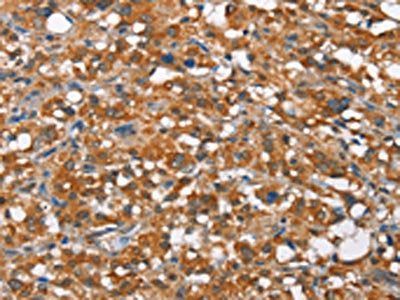 ARMCX2 Antibody
