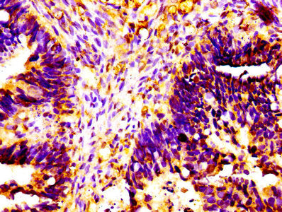 ALPL Antibody