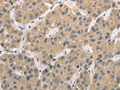 TRIB3 Antibody