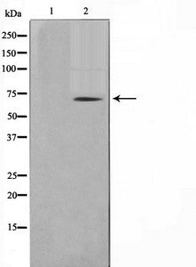 TGFBR2 Antibody