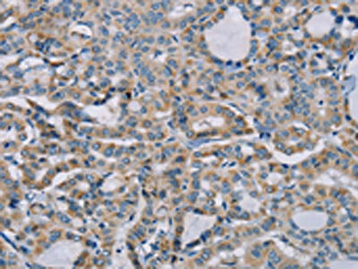 NDUFS7 Antibody