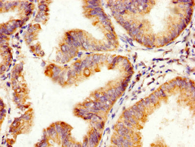 SPA17 Antibody