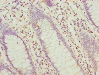 HABP2 Antibody