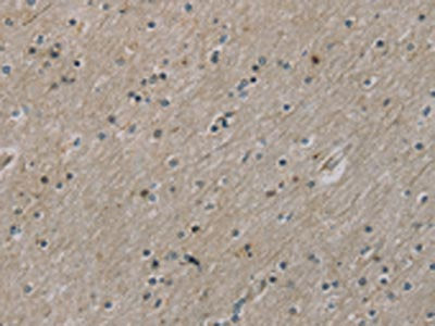 ROBO4 Antibody