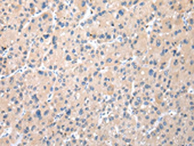 TXNDC11 Antibody