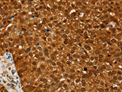 RAN Antibody