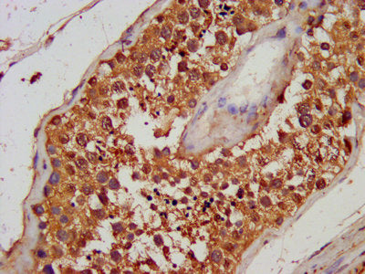 TG Antibody