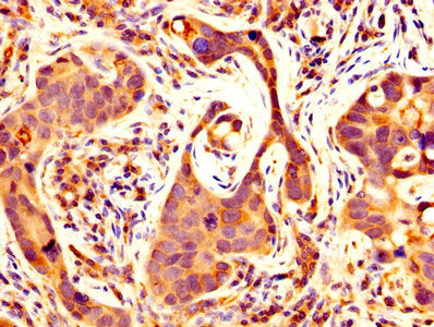 MMP14 Antibody