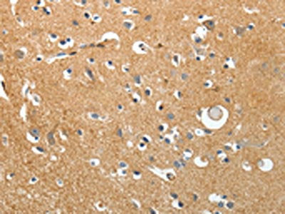 AKAP12 Antibody
