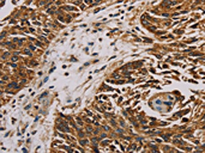 MRPL11 Antibody