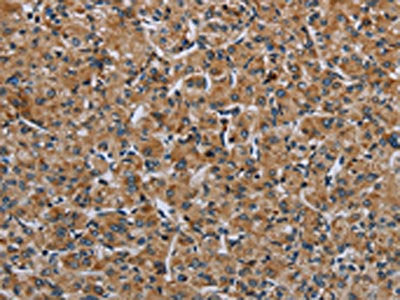 IL31RA Antibody