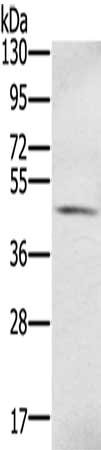 S100PBP Antibody