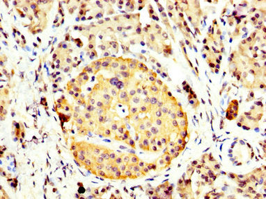 CCKBR Antibody
