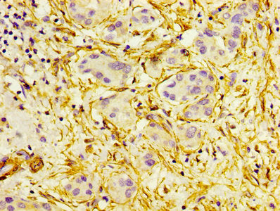 ACTA2 Antibody