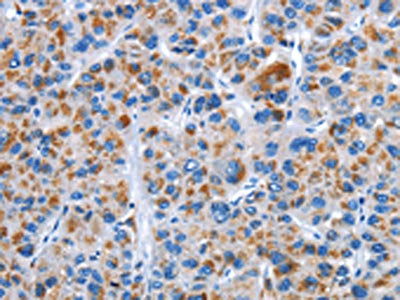 CENPJ Antibody