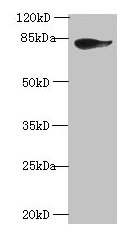 JUP Antibody