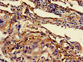 BCL2 Antibody