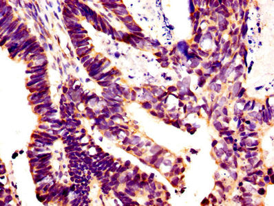 GLI1 Antibody